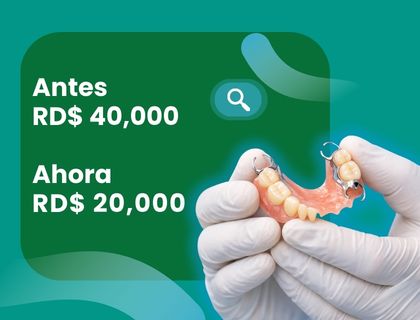 Oferta prótesis dentales 50% descuento en Santiago de los Caballeros - Credent RD